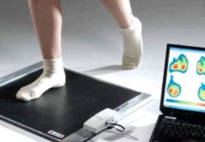 Dijagnoza hallux valgus