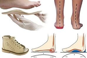 ortopedske cipele za hallux valgus kod djeteta