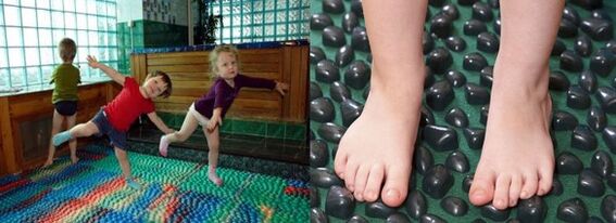 Gimnastika za valgus deformaciju
